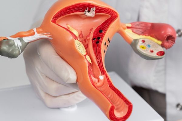 Hymenoplasty (Hymen Repairing Surgery)